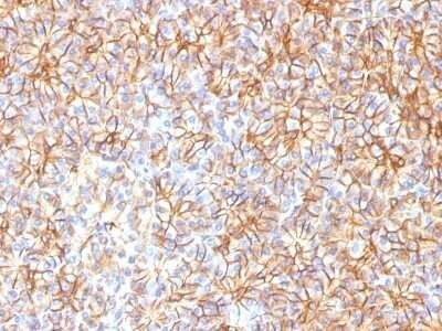 Immunohistochemistry-Paraffin: Spectrin beta 3 Antibody (SPTBN2/1584) - Azide and BSA Free [NBP2-54439]
