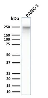 Western Blot: Spectrin beta 3 Antibody (SPTBN2/1584)Azide and BSA Free [NBP2-54439]