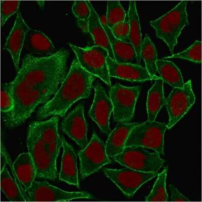 Immunocytochemistry/ Immunofluorescence: Spectrin beta 3 Antibody (SPTBN2/1584) [NBP2-53315]