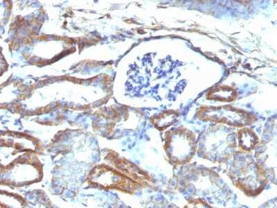 Immunohistochemistry-Paraffin: Spectrin beta 3 Antibody (SPTBN2/1584) [NBP2-53315]