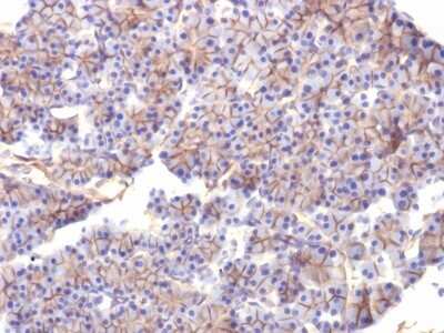 Immunohistochemistry-Paraffin: Spectrin beta 3 Antibody (SPTBN2/1584) [NBP2-53315]