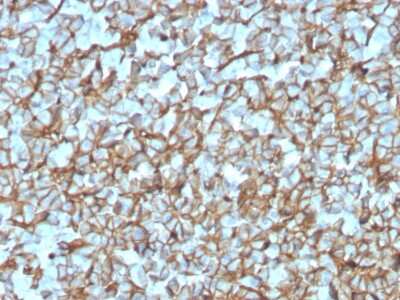 Immunohistochemistry-Paraffin: Spectrin beta 3 Antibody (SPTBN2/3142R) [NBP3-07294]