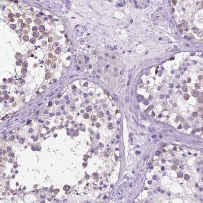 Immunohistochemistry-Paraffin: Speedy/Ringo Antibody [NBP2-49476]