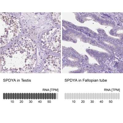 Immunohistochemistry-Paraffin: Speedy/Ringo Antibody [NBP2-49476]