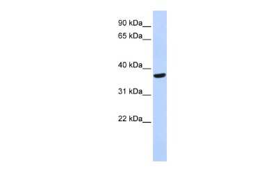 Western Blot: Speedy/Ringo Antibody [NBP2-88357]