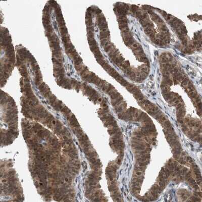 Immunohistochemistry-Paraffin: Sperm-associated antigen 7 Antibody [NBP1-90261]