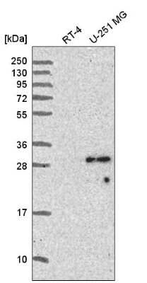 Western Blot: Sperm-associated antigen 7 Antibody [NBP2-56171]