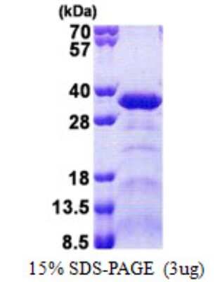 SDS-PAGE: Recombinant Human Sperm-associated antigen 7 His Protein [NBP2-22817]