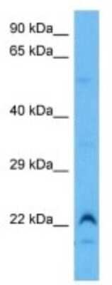 Western Blot: Spermine Binding Protein Antibody [NBP3-10996]