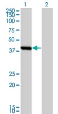 Western Blot: Spermine synthase Antibody (1G6) [H00006611-M01]