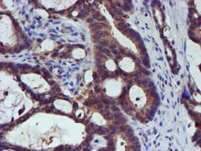 Immunohistochemistry: Spermine synthase Antibody (OTI3C9) - Azide and BSA Free [NBP2-74318]