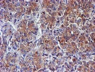 Immunohistochemistry: Spermine synthase Antibody (OTI3C9) - Azide and BSA Free [NBP2-74318]