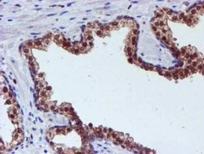 Immunohistochemistry: Spermine synthase Antibody (OTI3C9) - Azide and BSA Free [NBP2-74318]