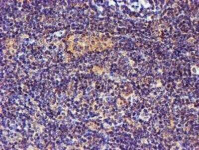 Immunohistochemistry: Spermine synthase Antibody (OTI3C9) - Azide and BSA Free [NBP2-74318]