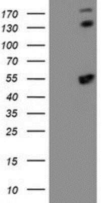 Western Blot: Spermine synthase Antibody (OTI3C9)Azide and BSA Free [NBP2-74318]