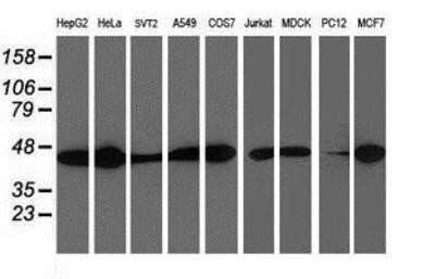 Western Blot: Spermine synthase Antibody (OTI3C9) [NBP2-00900]