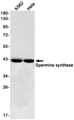 Western Blot: Spermine synthase Antibody (S05-5J5) [NBP3-19778]