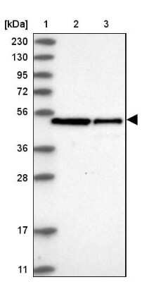 Western Blot: Spermine synthase Antibody [NBP1-87812]