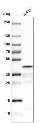 Western Blot: Spermine synthase Antibody [NBP1-87813]