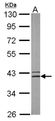Western Blot: Spermine synthase Antibody [NBP2-20470]