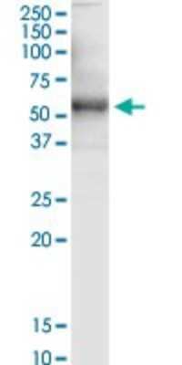 Western Blot: Sphingomyelin Synthase 2 Antibody (7D10) [H00166929-M08]