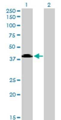 Western Blot: Sphingomyelin Synthase 2 Antibody (7D10) [H00166929-M08]