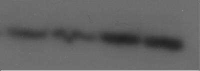 Western Blot: Sphingomyelin Synthase 2 Antibody [NBP1-60004]