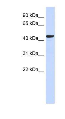 Western Blot: Sphingomyelin Synthase 2 Antibody [NBP1-60005]