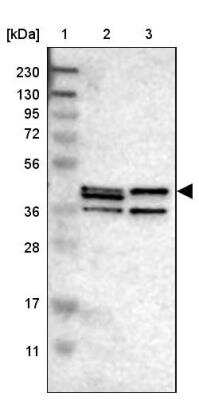 Western Blot: Sphingomyelin Synthase 2 Antibody [NBP1-92436]