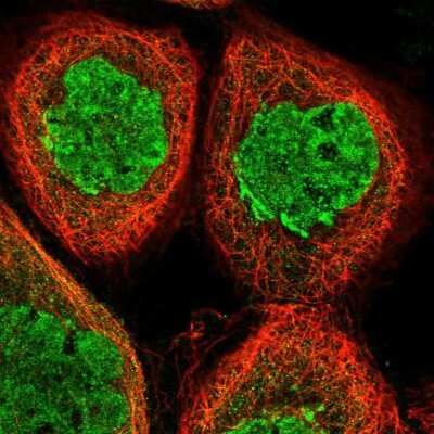 Immunocytochemistry/ Immunofluorescence: Sphingomyelin synthase 1 Antibody [NBP1-92435]