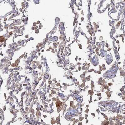 Immunohistochemistry-Paraffin: Sphingomyelin synthase 1 Antibody [NBP1-92435]