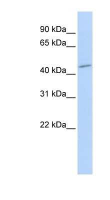 Western Blot: Sphingomyelin synthase 1 Antibody [NBP1-60081]