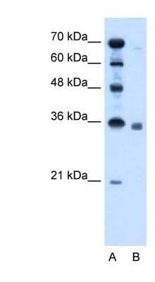 Western Blot: Sphingosine 1 phosphate phosphatase 2 Antibody [NBP1-53181]