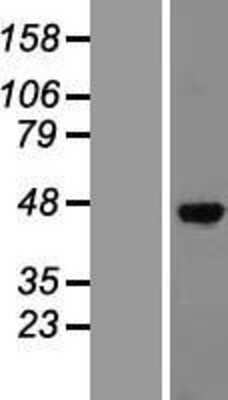 Western Blot: Sphingosine Kinase 1/SPHK1 Overexpression Lysate [NBP2-06490]