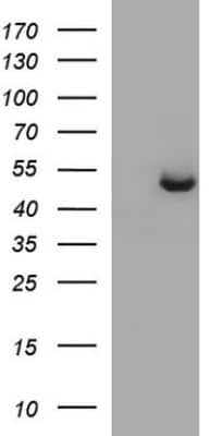 Western Blot: Sphingosine Kinase 1/SPHK1 Antibody (OTI1A6) [NBP2-45944]