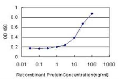 ELISA: Sphingosine Kinase 1/SPHK1 Antibody (1D6) [H00008877-M01]
