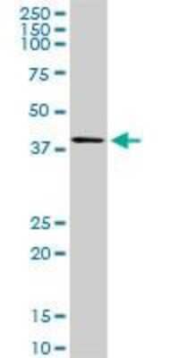Western Blot: Sphingosine Kinase 1/SPHK1 Antibody (1D6) [H00008877-M01]