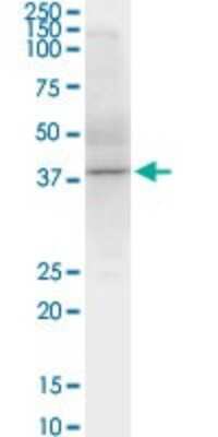 Western Blot: Sphingosine Kinase 1/SPHK1 Antibody (1D6) [H00008877-M01]