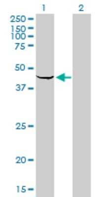 Western Blot: Sphingosine Kinase 1/SPHK1 Antibody (1D6) [H00008877-M01]