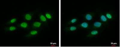 Immunocytochemistry/ Immunofluorescence: Sphingosine Kinase 1/SPHK1 Antibody [NBP2-20472]