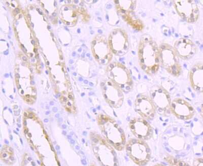 Immunohistochemistry-Paraffin: Sphingosine Kinase 1/SPHK1 Antibody (JA31-14) [NBP2-67164]