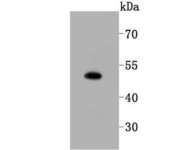 Western Blot: Sphingosine Kinase 1/SPHK1 Antibody (JA31-14) [NBP2-67164]