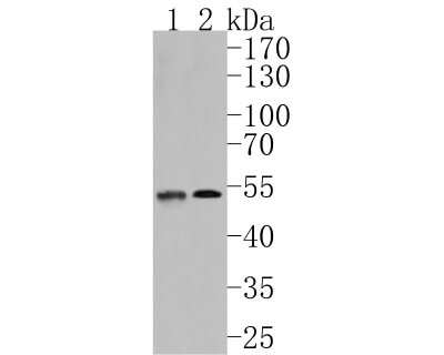 Western Blot: Sphingosine Kinase 1/SPHK1 Antibody (JA31-14) [NBP2-67164]