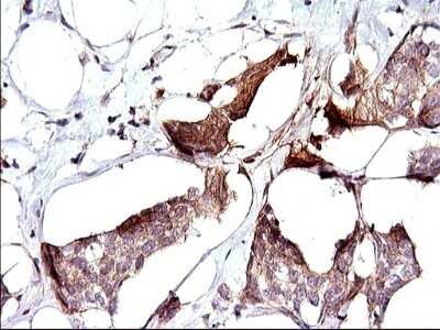 Immunohistochemistry: Sphingosine Kinase 1/SPHK1 Antibody (OTI1A6) - Azide and BSA Free [NBP2-74332]