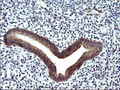 Immunohistochemistry: Sphingosine Kinase 1/SPHK1 Antibody (OTI1A6) - Azide and BSA Free [NBP2-74332]