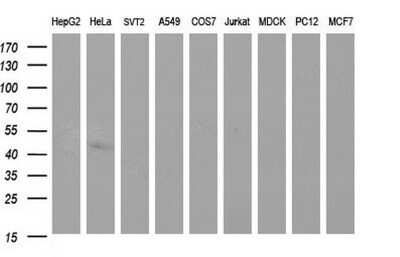 Western Blot: Sphingosine Kinase 1/SPHK1 Antibody (OTI1A6)Azide and BSA Free [NBP2-74332]