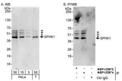 Western Blot: Sphingosine Kinase 1/SPHK1 Antibody [NBP1-22974]