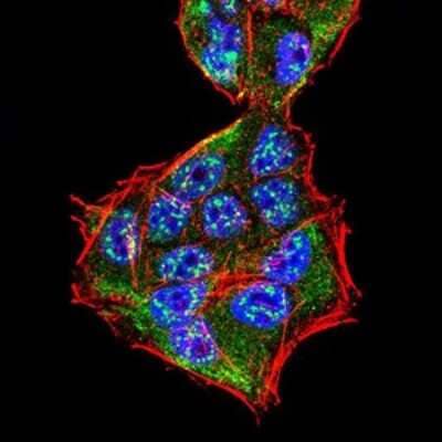 Immunocytochemistry/ Immunofluorescence: Sphingosine Kinase 2/SPHK2 Antibody (3C8D3) - BSA Free [NBP2-52566]