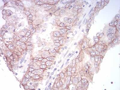 Immunohistochemistry-Paraffin: Sphingosine Kinase 2/SPHK2 Antibody (3C8D3) - BSA Free [NBP2-52566]