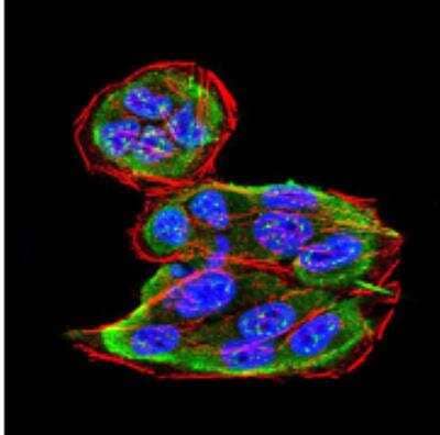 Immunocytochemistry/ Immunofluorescence: Sphingosine Kinase 2/SPHK2 Antibody (9C5E1) - BSA Free [NBP2-52567]